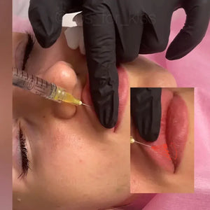 LIPS FOR KISS DIAMOND PACK - THE ULTIMATE AESTHETIC MASTERY COLLECTION