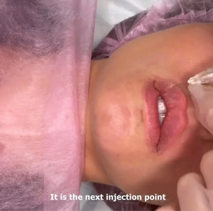 LIPS FOR KISS DIAMOND PACK - THE ULTIMATE AESTHETIC MASTERY COLLECTION