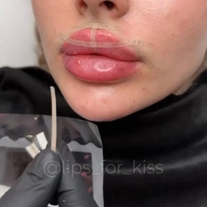 LIPS FOR KISS DIAMOND PACK - THE ULTIMATE AESTHETIC MASTERY COLLECTION