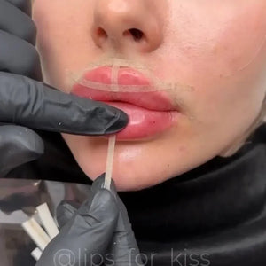 LIPS FOR KISS DIAMOND PACK - THE ULTIMATE AESTHETIC MASTERY COLLECTION