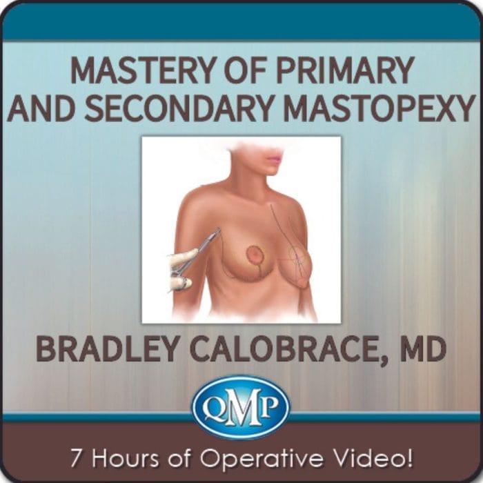 Mastery of Primary and Secondary Mastopexy