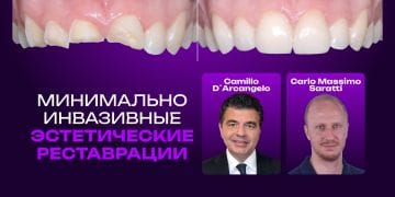 Minimally Invasive Esthetic Restorations: Additive, Digital, and Functional Rehabilitation