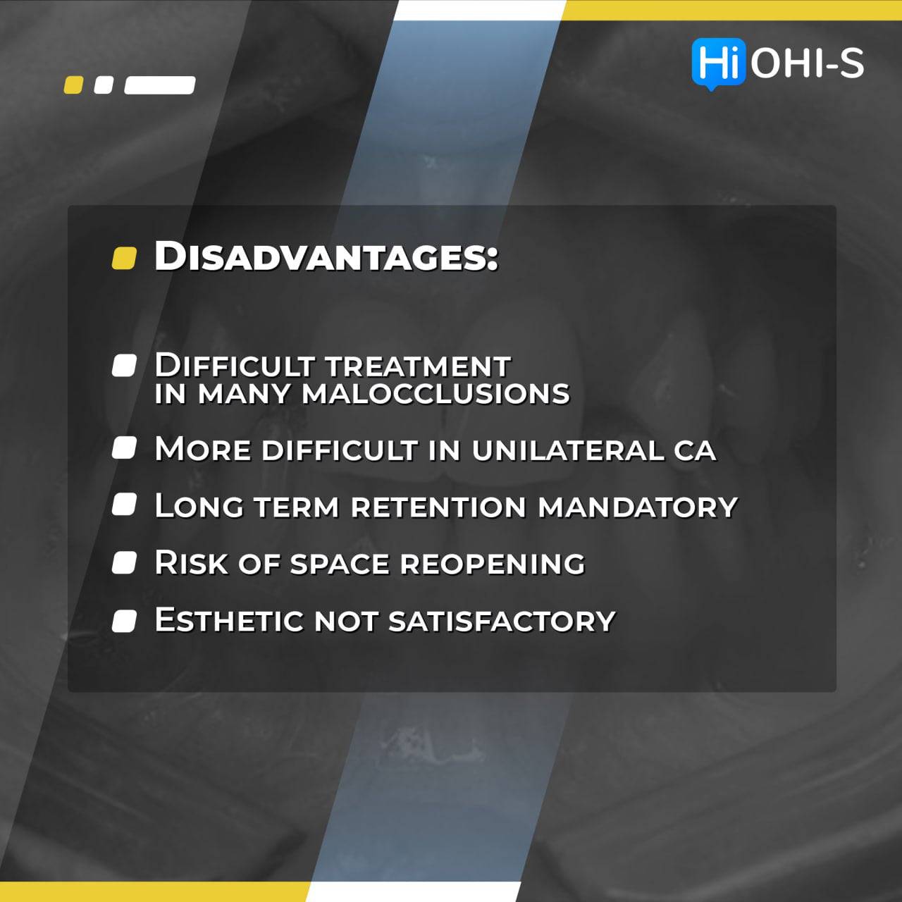 Missing Maxillary Lateral Incisors: Space Closure in all Malocclusions vs Implants and Prosthetic Replacement