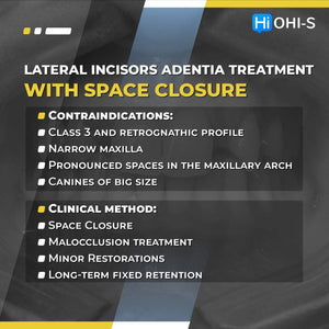 Missing Maxillary Lateral Incisors: Space Closure in all Malocclusions vs Implants and Prosthetic Replacement