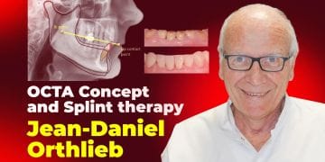OCTA concept and splint therapy