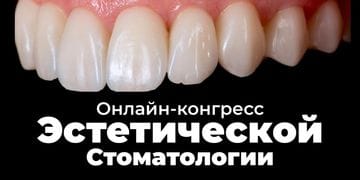Online Congress of Aesthetic Dentistry: Proprietary Concepts by Klaus Müterthies, Edris Rasta, and Maurizio De Stefano