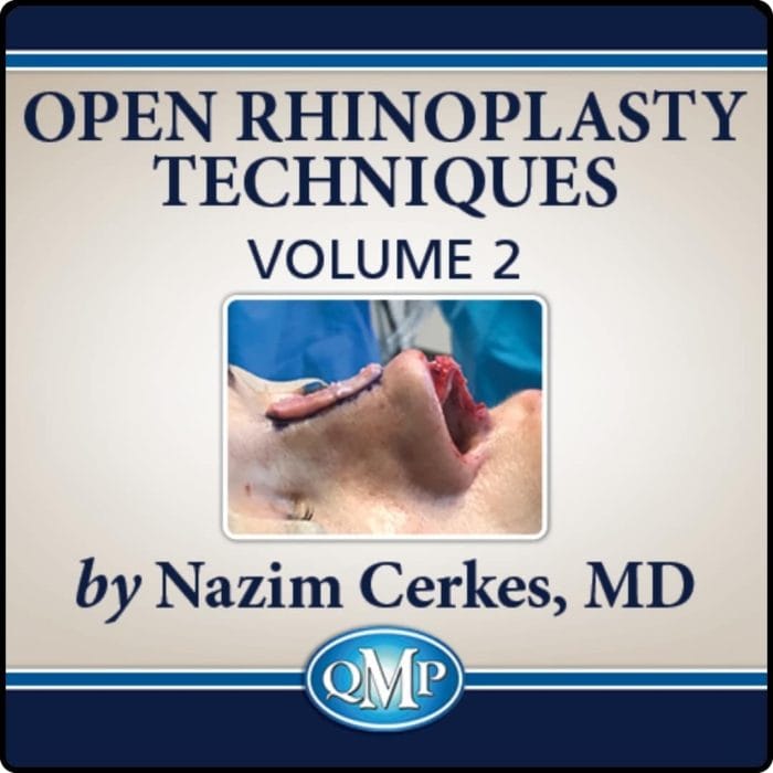 Open Rhinoplasty Techniques, Volume 2