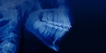 Orthodontic treatment in patients with periodontal and alveolar bone pathology