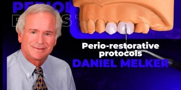 Perio-restorative protocols: team-based approach