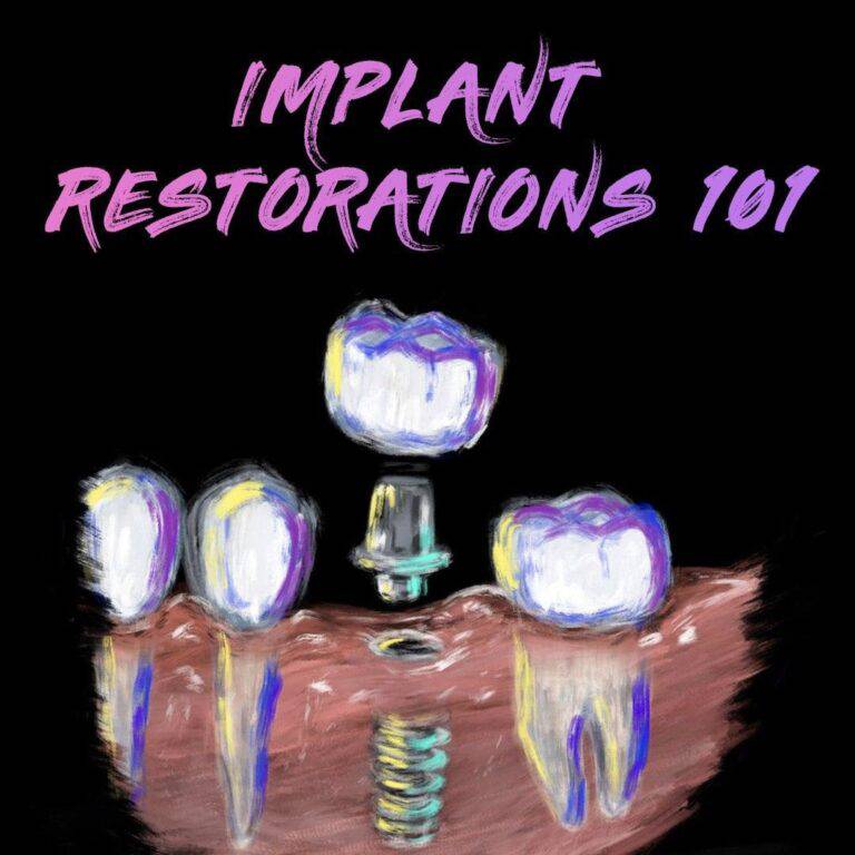 Implant Restorations 101 – Implant Ninja - Dental Courses | كورسات طب اسنان