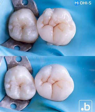 The Biomimetic Concept: Composite Restoration Protocols