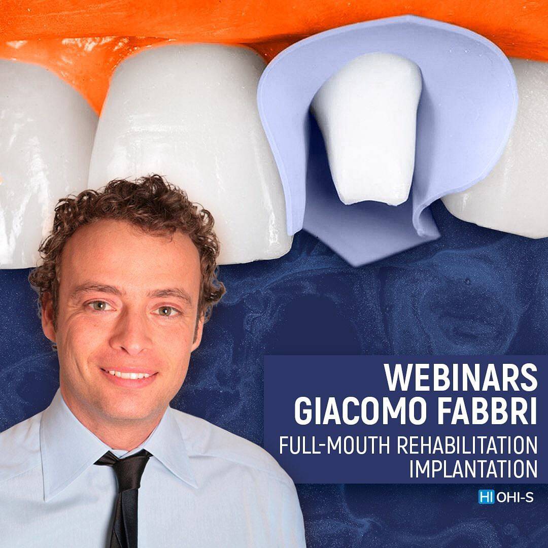 OHI-S Full-Mouth Rehabilitation Based on Implants and Natural Teeth – Giacomo Fabbri - Dental Courses | كورسات طب اسنان