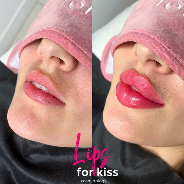 Lips For Kiss Updated Course