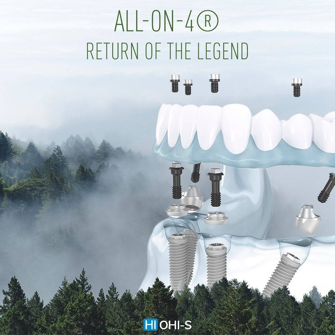 OHI-S All-On-4 Implant Prosthesis - Dental Courses | كورسات طب اسنان