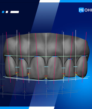 full rehabilitation in prosthetic dentistry - Mauro Fradeani