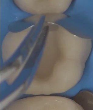 International Schools Working With Composite Restorations