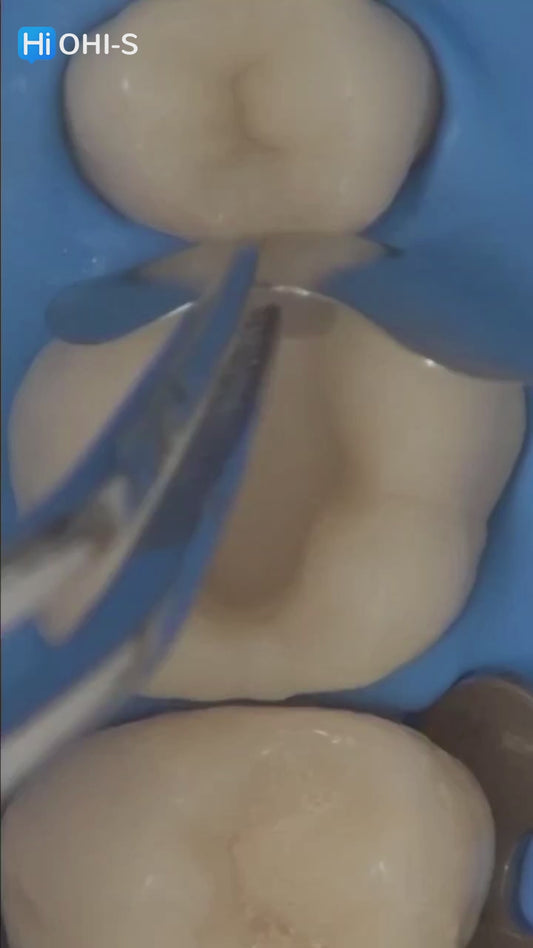 International Schools Working With Composite Restorations