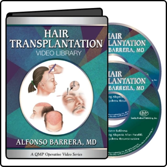 Quality Medical Publishing Hair Transplantation 2017