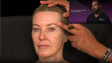 Botox and filler online course - RA Summit 2024