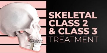 Skeletal Class 2 & Class 3 treatment: team approach "orthodontist-surgeon"