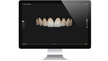 Smile Designer PRO 3.4 Installation Service (1 PC)
