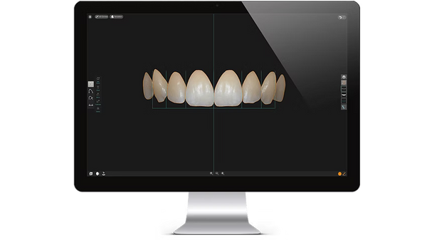 Smile Designer PRO 3.4 Installation Service (1 PC)