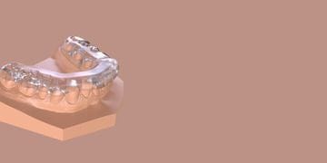 The occlusal Plane System - predictable approach when dealing with complex and functional cases in everyday practice