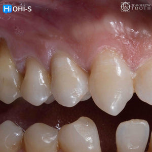Vertical Preparation Protocols: The Complete Guide in 24 Lessons from Tomorrow Tooth